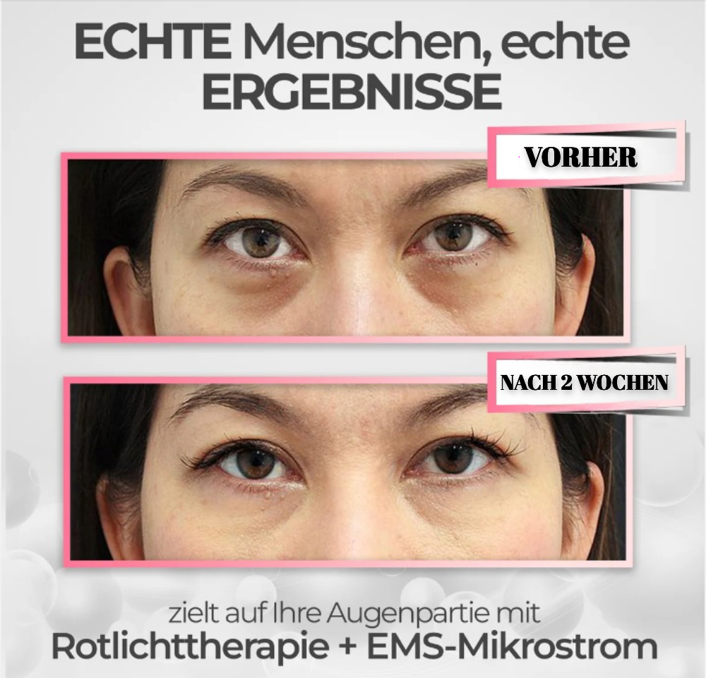 RevitalEyes™ Fortschrittliche Regenerationstherapie unter den Augen