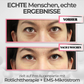 RevitalEyes™ Fortschrittliche Regenerationstherapie unter den Augen