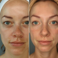 RevitalEyes™ Fortschrittliche Regenerationstherapie unter den Augen